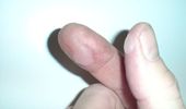 Motsens fingre efter at have fjernet Suzuki og Swift emblemet bagp�